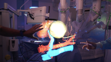 RAISE e ricostruzione 3D di organi: un progetto di Spoke 2